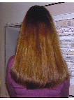 prohair2m